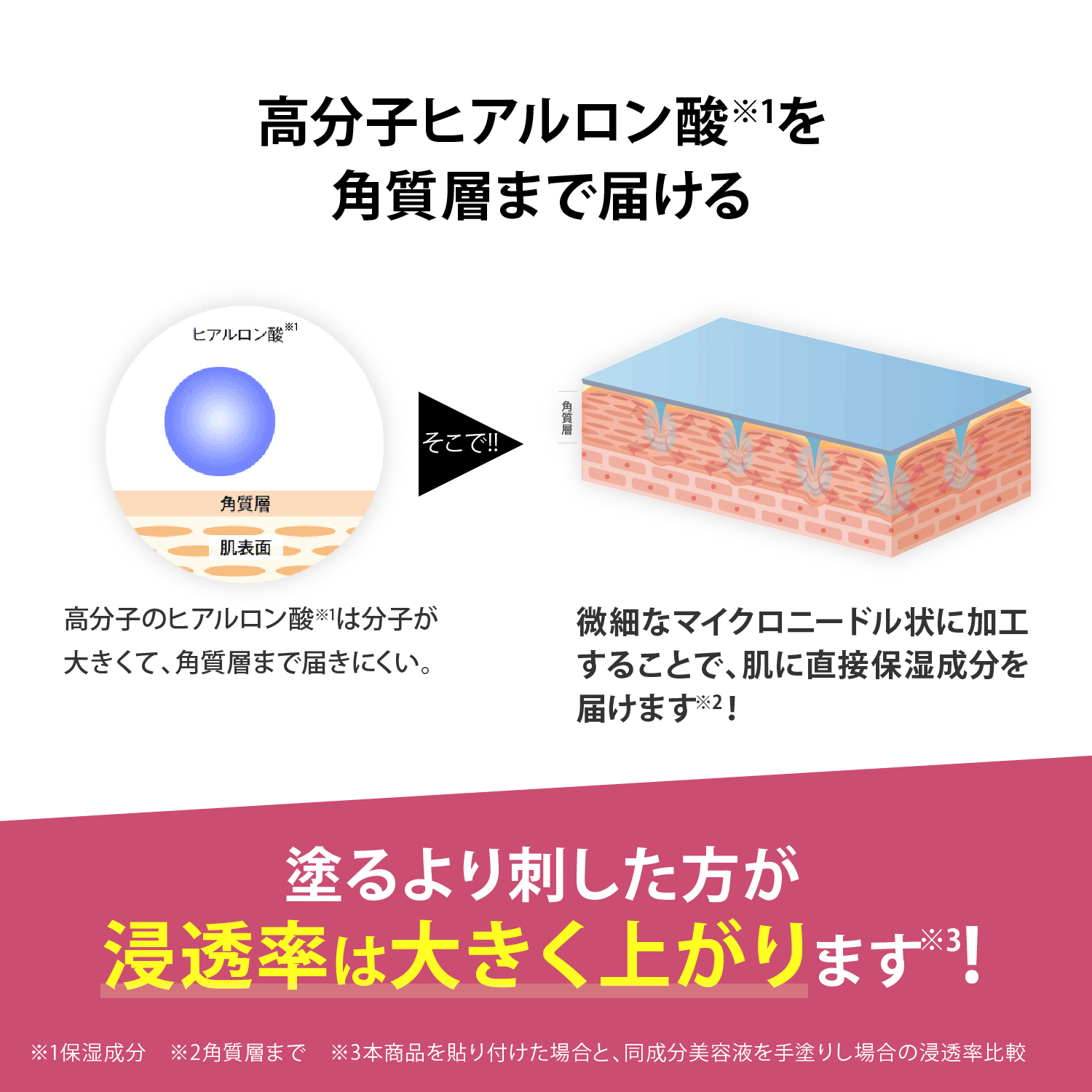 メディリフト 3Dマイクロフィラー4袋入り｜ヤーマン公式通販サイト 