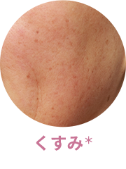 くすみ
