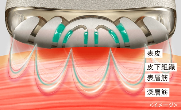 表層筋～深層筋までケアイメージ