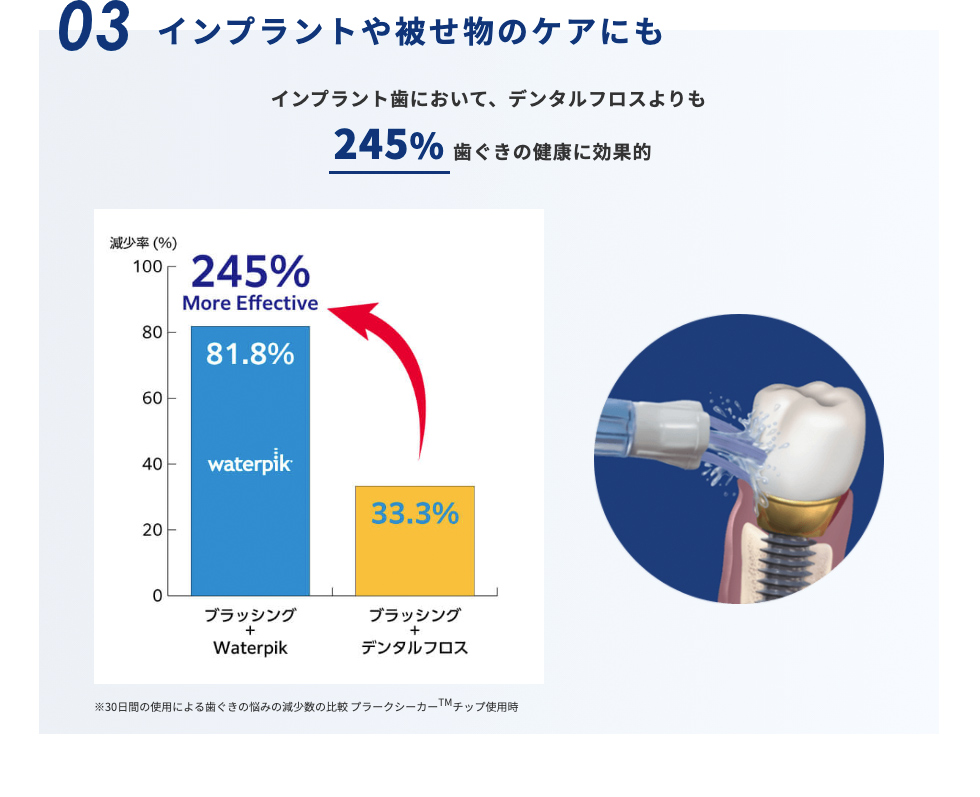 ウォーターピック コードレスセレクト | ヤーマン公式通販サイト